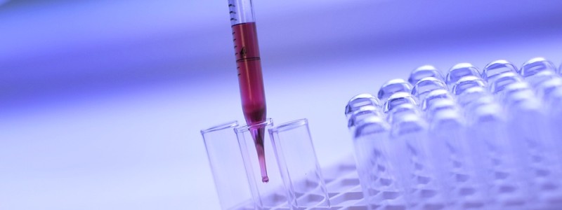 Nové objevy při výzkumu Alzheimerovy choroby